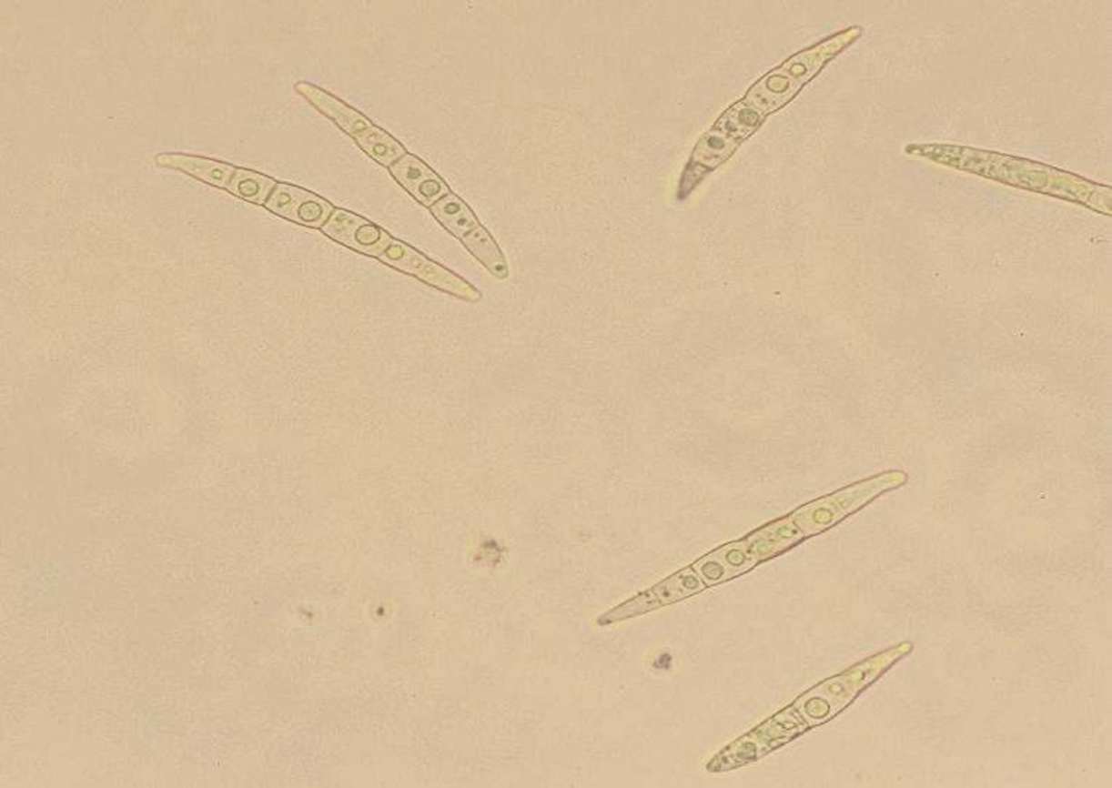 Lebenszyklus von Leptosphaeria maculans
